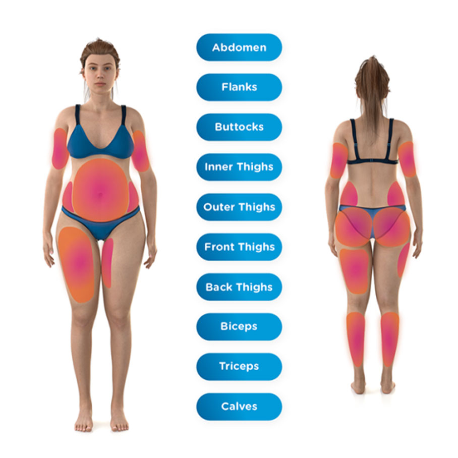 Diagram showing target areas of ENSCULPT NEO in Dr Phillips, FL